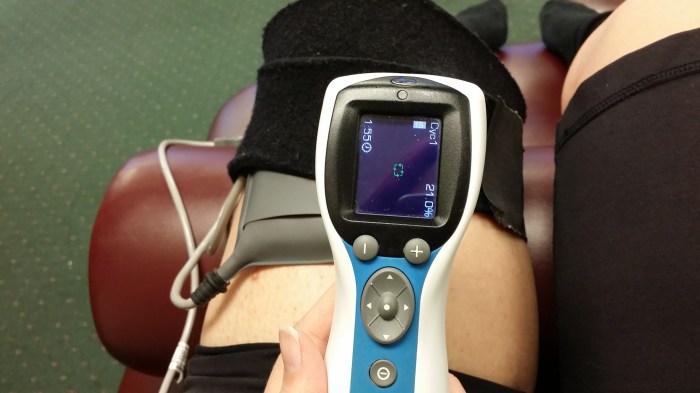 De zenuwstimulering. Vaag apparaatje